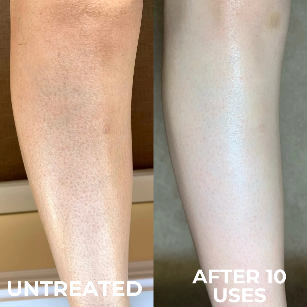 Everkind Advanced Strawberry Resurfacing Complex